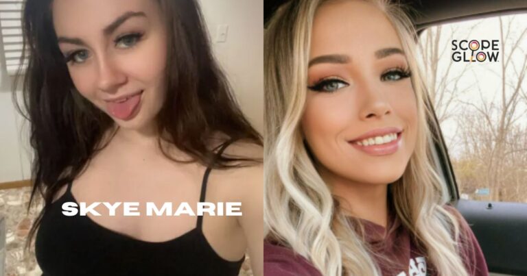 Skye Marie Net Worth – Is She a Millionaire?